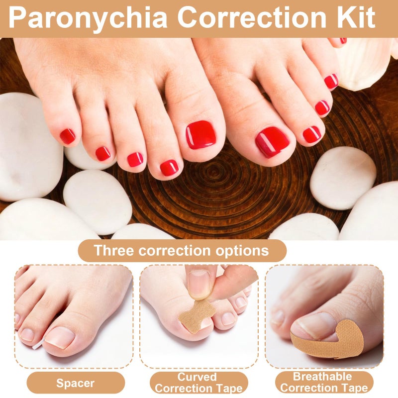 Sinbana 16pcs Ingrown Toenail Kit, with Breathable In-Growing Toenail Strips Curved Toes Correction Plaster Patches Painless File and Lifting Pedicure Tools for Women Men - Image 3